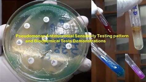 Pseudomonas Media and Tests .